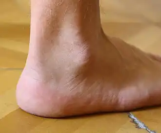 Правый голеностопный сустав, вид сбоку.