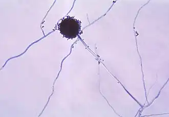 Конидий у Aspergillus niger