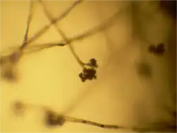 Конидиеносцы с конидиями Botrytis cinerea (увеличение 40×)