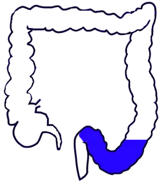 Сигмовидная ободочная кишка обозначена синим