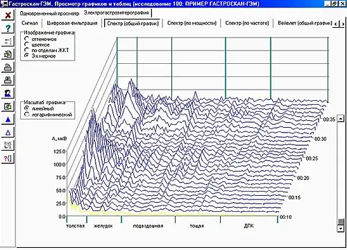 Электрогастроэнтеро- грамма человека