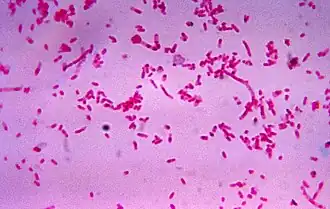 Fusobacterium novum