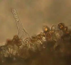 Полупрозрачная, остроконечная клетка с закруглённым кончиком, протягивающаяся вверх в чистый район. Его база находится среди слоя плохо разделённых и более мелких клеток, большинство из которых прилагается к другим коричневым овальным клеткам.