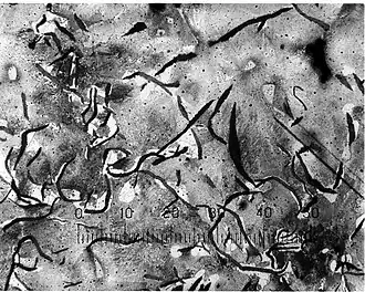 Микрофотография серого чугуна; структура перемежается черными чешуйками пластинчатого графита