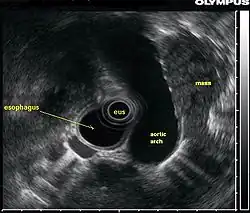 Lul mass radial eus.jpg