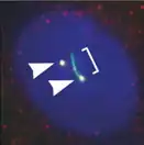 Локализация MKS1-протеина в центриолях / базальном тельце цилии. Картинка получена методом иммунофлуоресцентного анализа