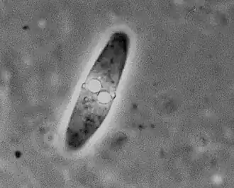 Споры Alataspora solomoni[уточнить]