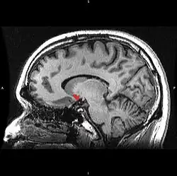 Сагітальна проекція