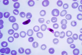 Мазок крови с Plasmodium falciparum