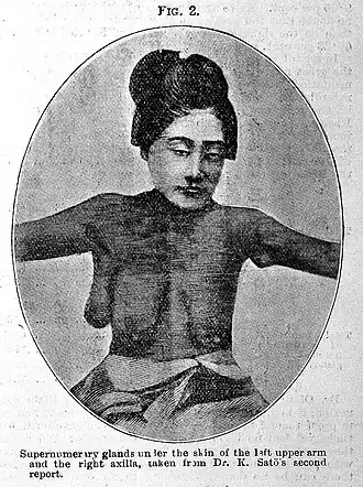 Женщина с несколькими дополнительными грудями