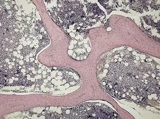 Микрофотография губчатого вещества, демонстрирующая его трабекулы (розовые) и мозговое вещество (синее).