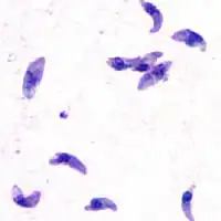 Токсоплазма (Toxoplasma gondii) — самый распространённый паразит-простейшее, который может попадать в организм человека через пищевые продукты (животного происхождения). Вызывает токсоплазмоз, который приводит к тератогенному эффекту (уродства), олигофрении, поражениям нервной системы или гибели плода, у взрослых в острой форме протекает подобно брюшному тифу, с увеличением некоторых внутренних органов (печени, селезёнки), температурой или с поражением нервной системы, может протекать и бессимптомно. Токсоплазмы также обладают свойствами влиять на сознание организма носителя[источник не указан 739 дней]