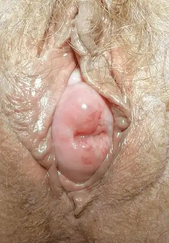 Наружный маточный зев шейки матки в просвете половой щели между половыми губами