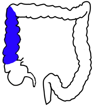 Восходящая ободочная кишка обозначена синим