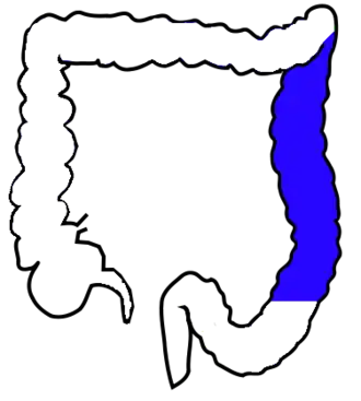 Нисходящая ободочная кишка обозначена синим