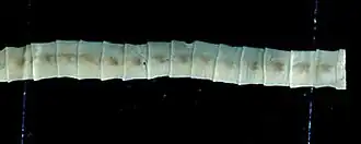 Diphyllobothrium latum