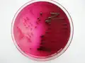Чистая культура кишечных палочек на плотной элективной питательной среде (среда Эндо) на чашке Петри
