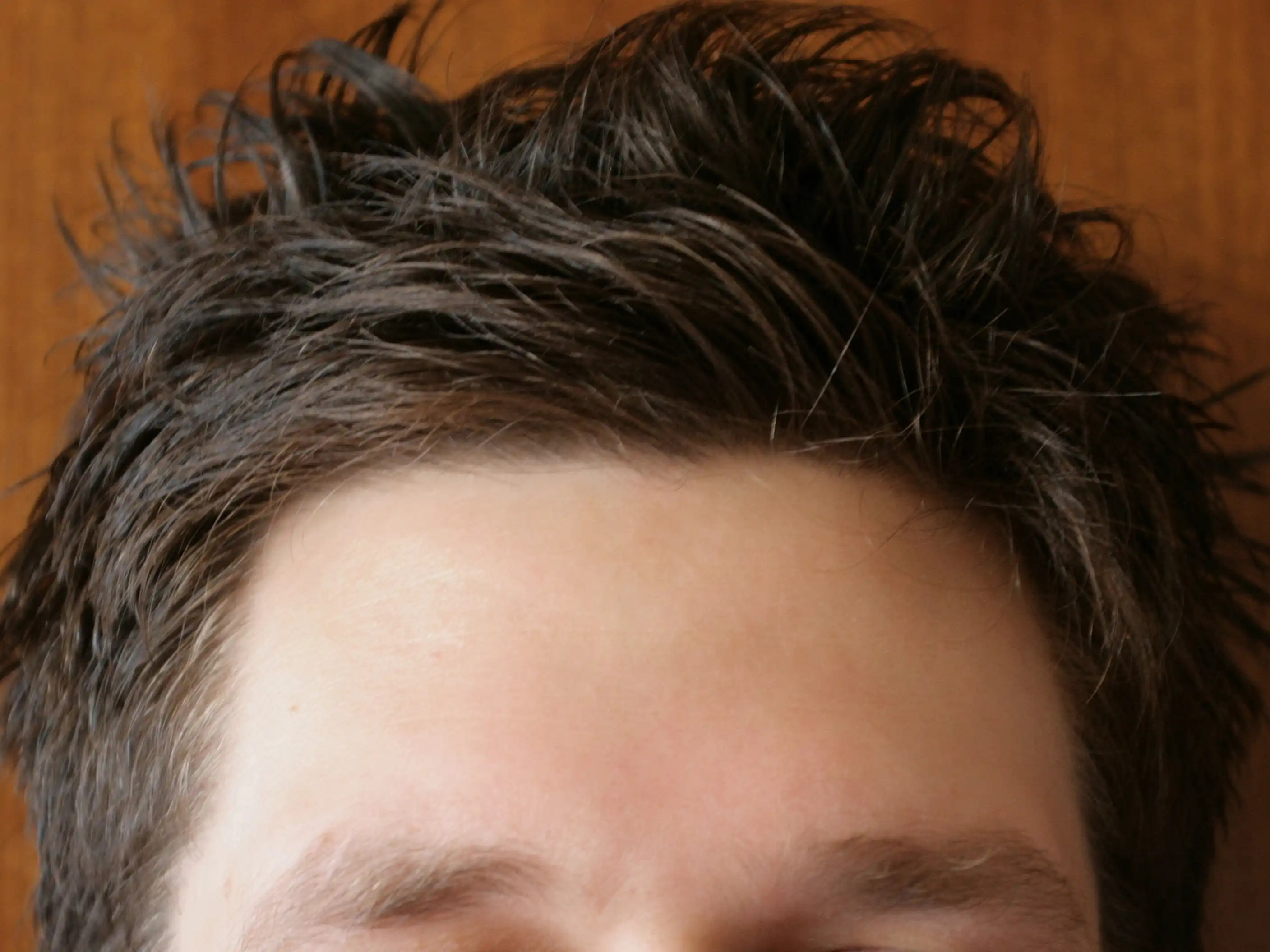 Male_forehead-01_ies