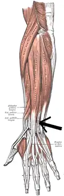 Разгибатель мизинца указан стрелкой