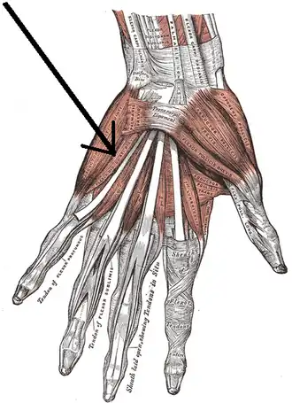 Короткий сгибатель мизинца отмечен стрелкой
