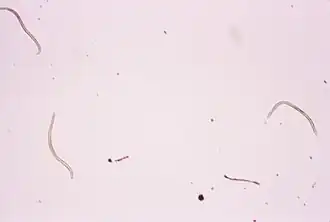 Onchocerca volvulus — возбудитель онхоцеркоза