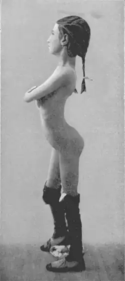 Лордотическая осанка