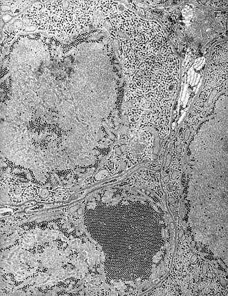 Микрофотография возбудителя инфекции